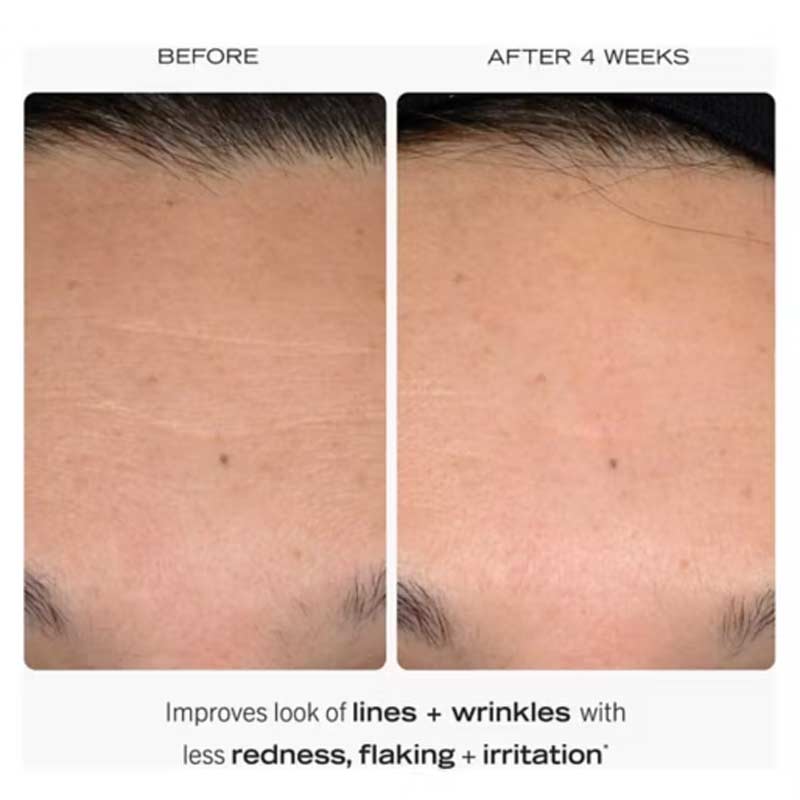First Aid Beauty 0.3% Retinol Complex Serum with Peptides