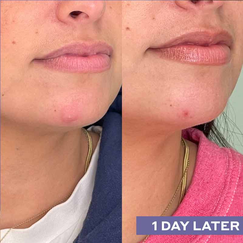 Mario Badescu Repairing Facial Spray With Hypochlorous Acid