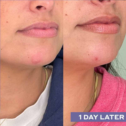 Mario Badescu Repairing Facial Spray With Hypochlorous Acid