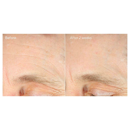 Murad Intense Recovery Cream
