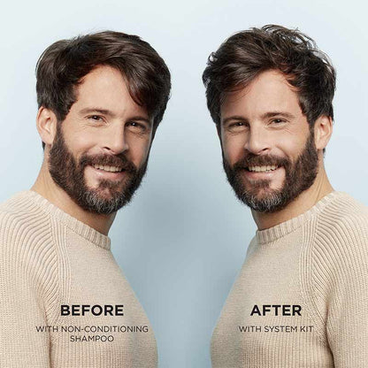 Nioxin System 2 Three Part Loyalty Kit for Progressed Thinning
